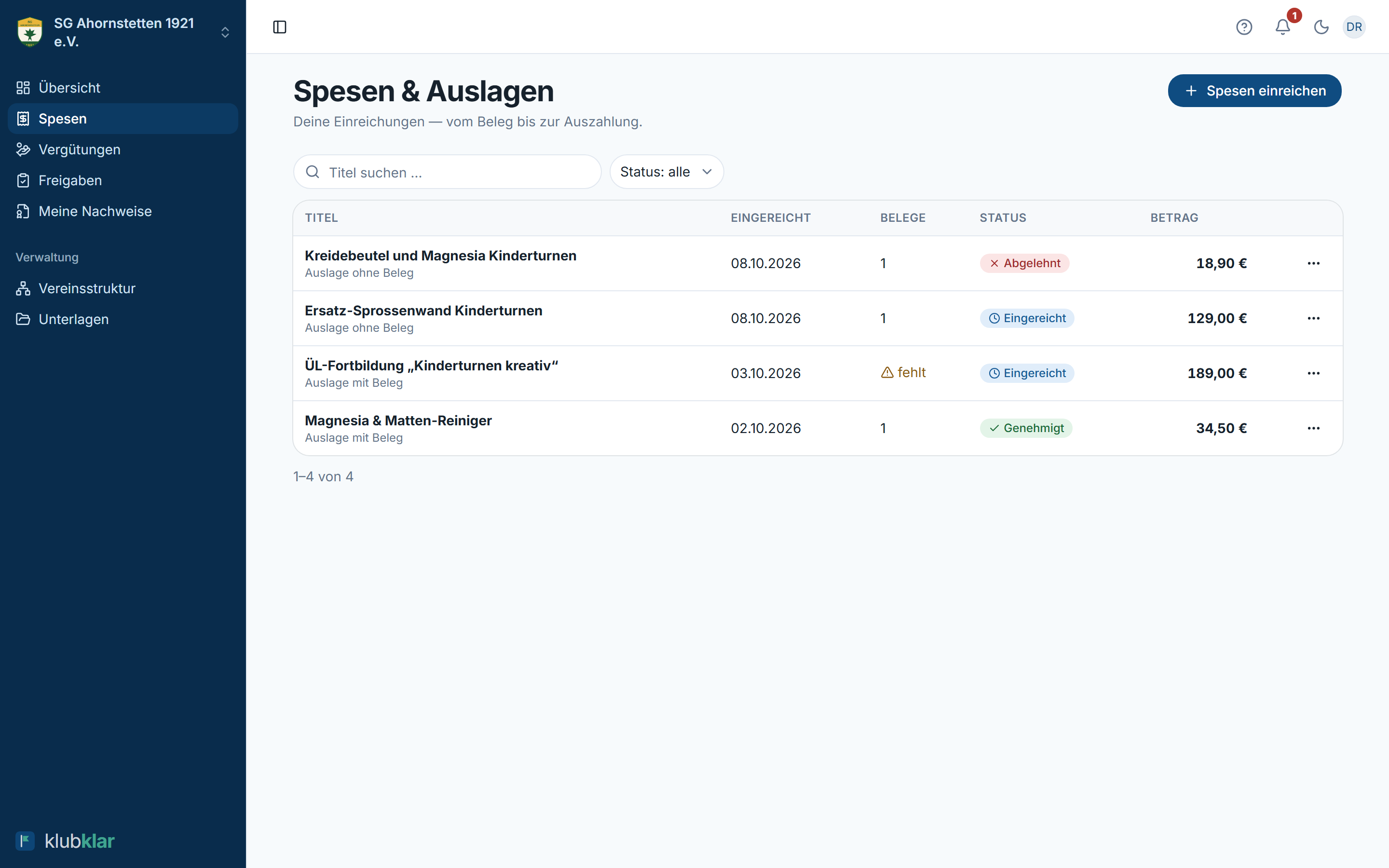 Spesenliste mit Status, Betrag und Belegen